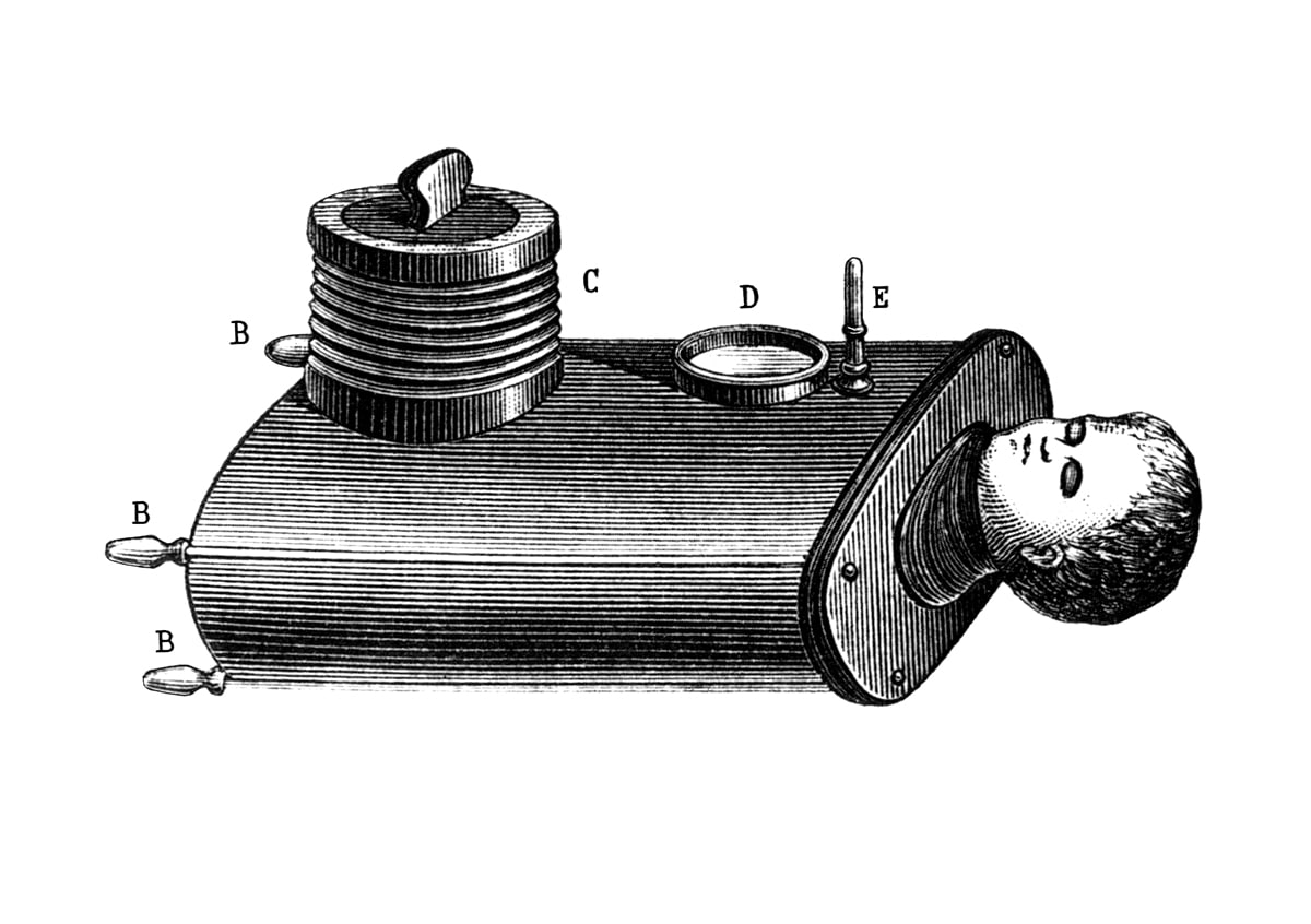 Iron lung for babies, Woillez 1876
