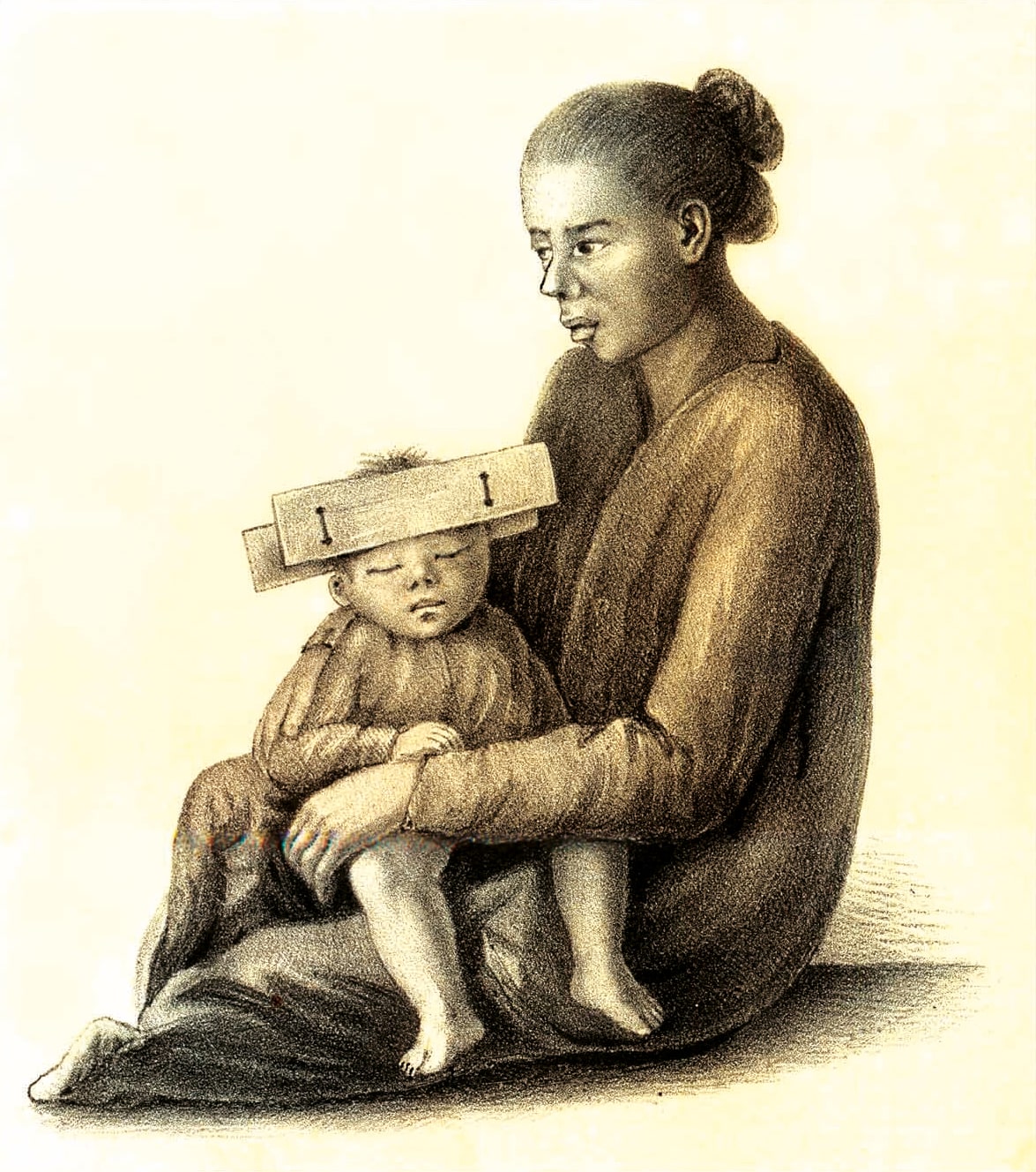 Skull shaping in Sulawesi, Riedel 1871