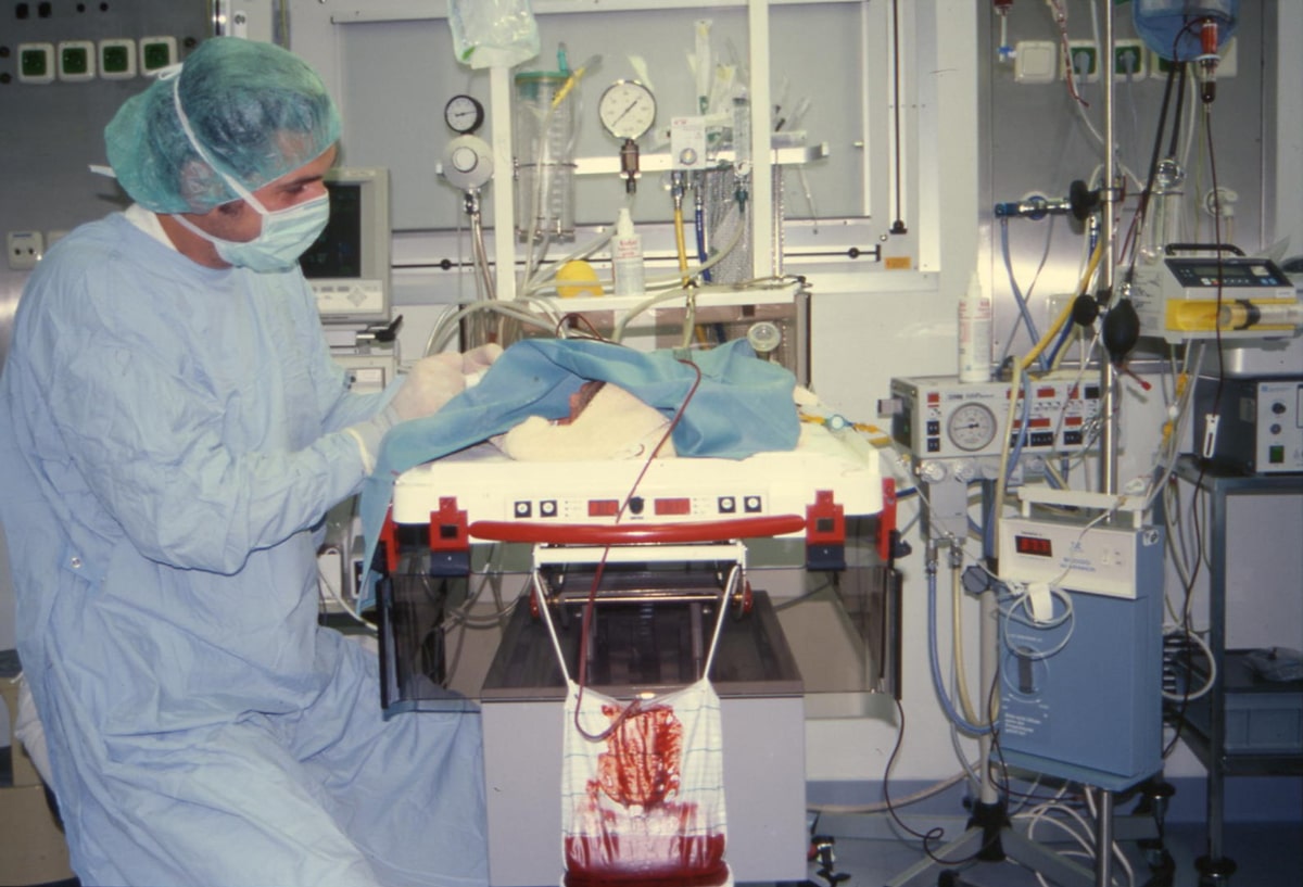Exchange transfusion