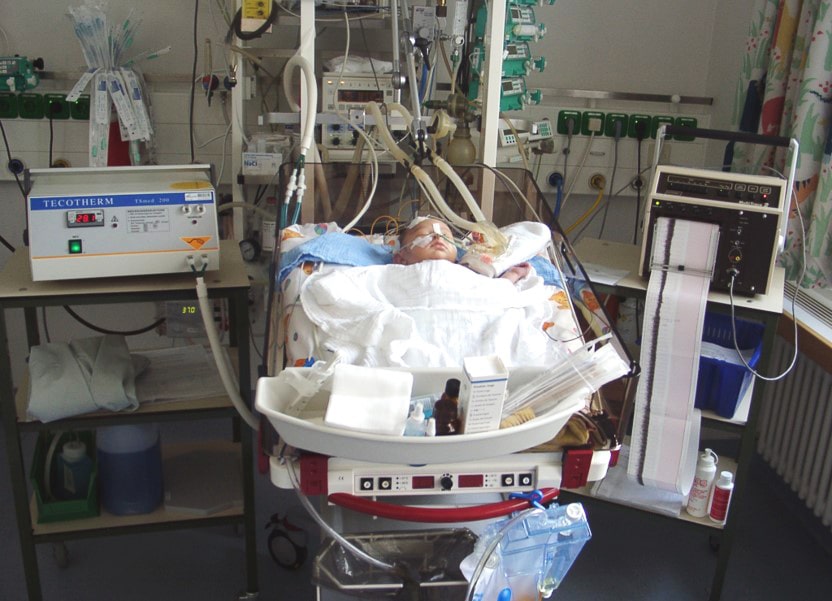 Hypothermia treatment after asphyxia